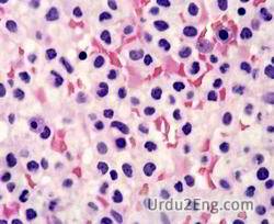 leukemia Urdu Meaning