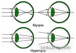 myopia Urdu Meaning