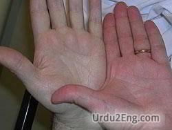 anemia Urdu Meaning
