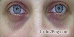 anemia Urdu Meaning