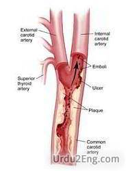 artery Urdu Meaning