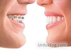 brace Urdu Meaning
