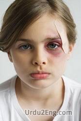 bruise Urdu Meaning
