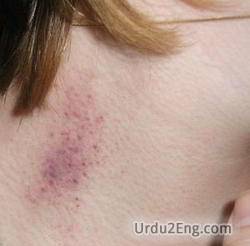 hickey Urdu Meaning