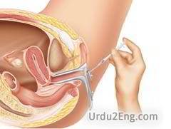 insemination Urdu Meaning