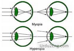 nearsightedness Urdu Meaning
