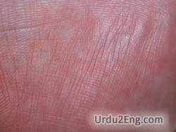 skin tag meaning in urdu