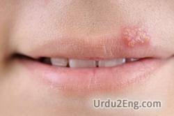 sore Urdu Meaning